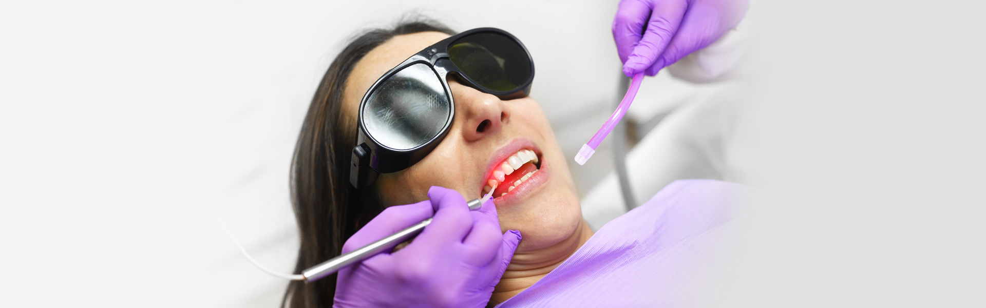 What Are Dental Lasers in Dentistry?