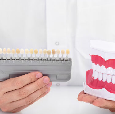 Dental Laminates in Minnetonka